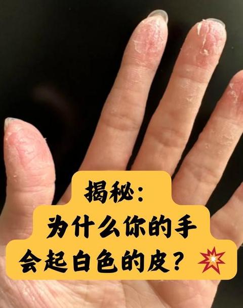 手上的油漆怎么洗掉？多种方法快速清洁指南