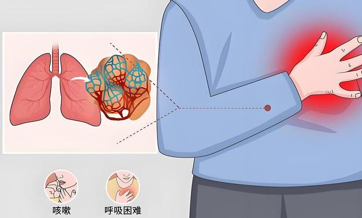 常见农药中毒急救方法全解析