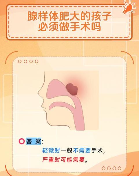 孩子腺样体肥大80%堵塞，手术还是保守治疗？