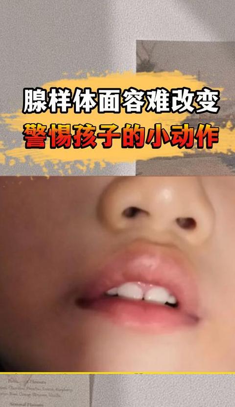 孩子腺样体肥大危害大盘点